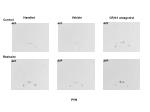 Effects of CRHr1 Antagonist on AVP, GHRH, and SRIF mRNA Expression in Restraint Stress Models - slide 1