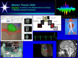 Master Thesis 2005 Wavelets (A relative new Mathematical method) in Medical Image Processing