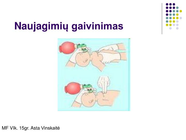 naujagimi gaivinimas