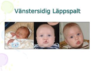 v nstersidig l ppspalt