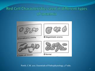 Red Cell Characteristics seen in different types of anaemia