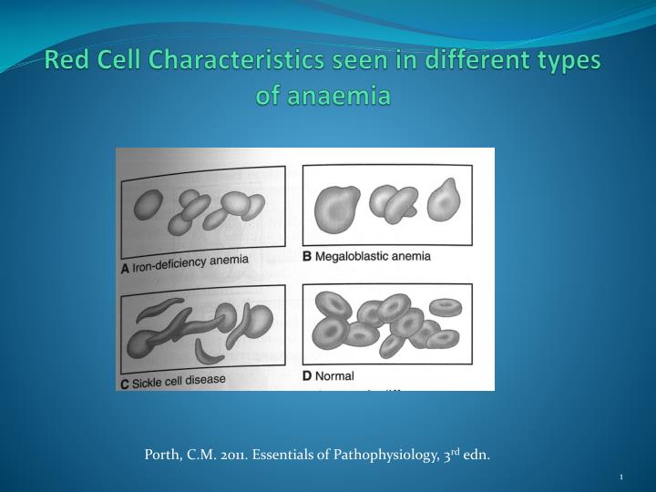 red cell characteristics seen in different types of anaemia