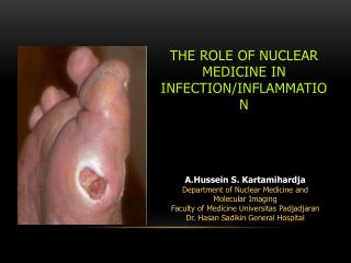 The Role of Nuclear Medicine in Infection/inflammation