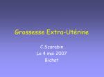 Grossesse Extra-Utérine - slide 1