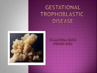 Gestational trophoblastic disease dr.maryam bakir fibogo-dgo