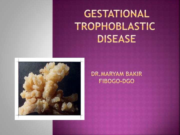 gestational trophoblastic disease dr maryam bakir fibogo dgo