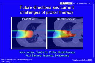 Future directions and current challenges of proton therapy