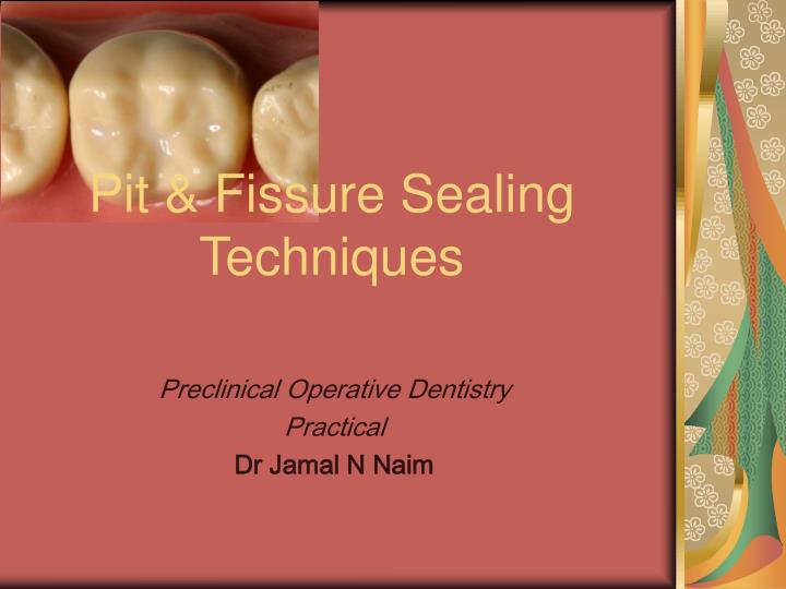 pit fissure sealing techniques