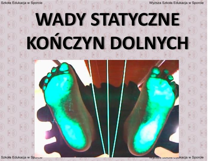 wady statyczne ko czyn dolnych