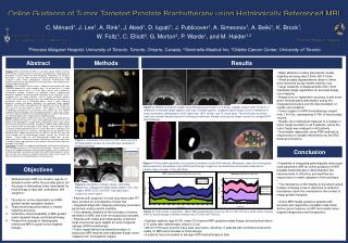 Online Guidance of Tumor Targeted Prostate Brachytherapy using Histologically Referenced MRI