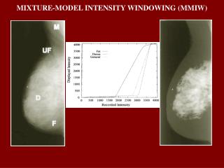 MIXTURE-MODEL INTENSITY WINDOWING (MMIW)