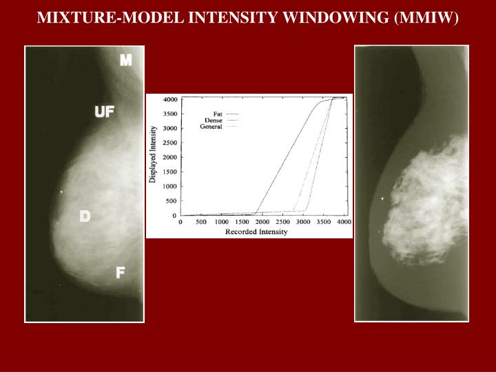 mixture model intensity windowing mmiw