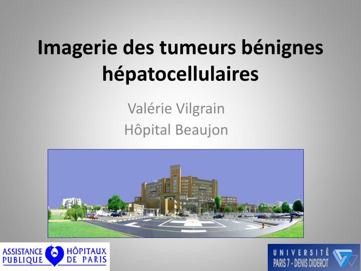 imagerie des tumeurs b nignes h patocellulaires