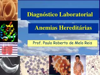 anemias heredit rias