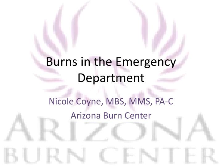 burns in the emergency department