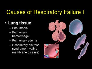 Causes of Respiratory Failure I