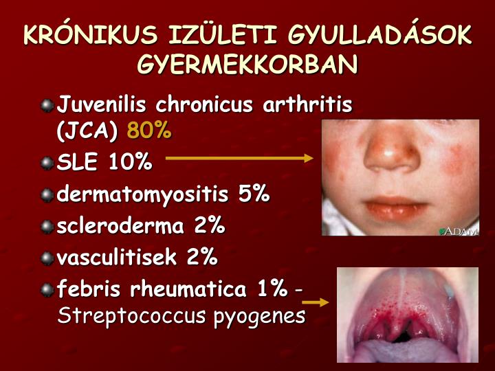 kr nikus iz leti gyullad sok gyermekkorban