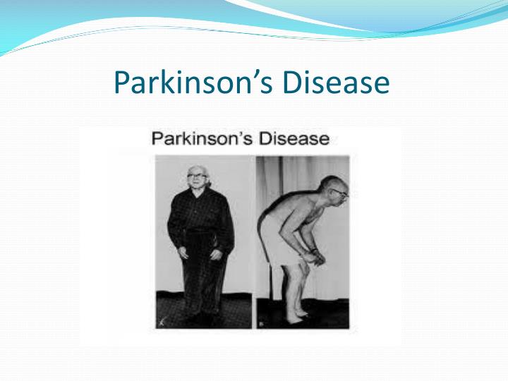 parkinson s disease