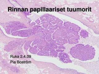 rinnan papillaariset tuumorit