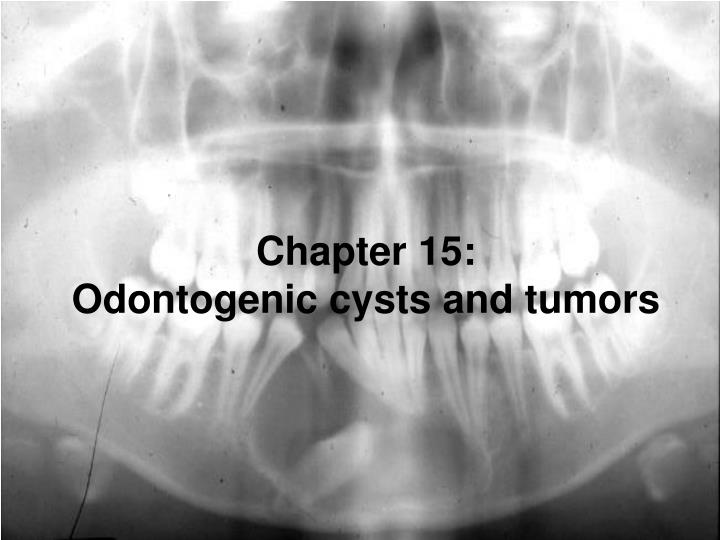 chapter 15 odontogenic cysts and tumors