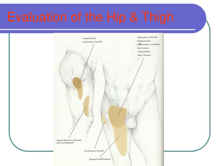 evaluation of the hip thigh