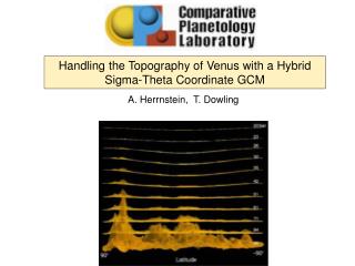 Handling the Topography of Venus with a Hybrid Sigma-Theta Coordinate GCM
