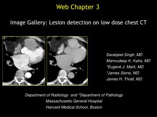 Image Gallery: Lesion detection on low dose chest CT