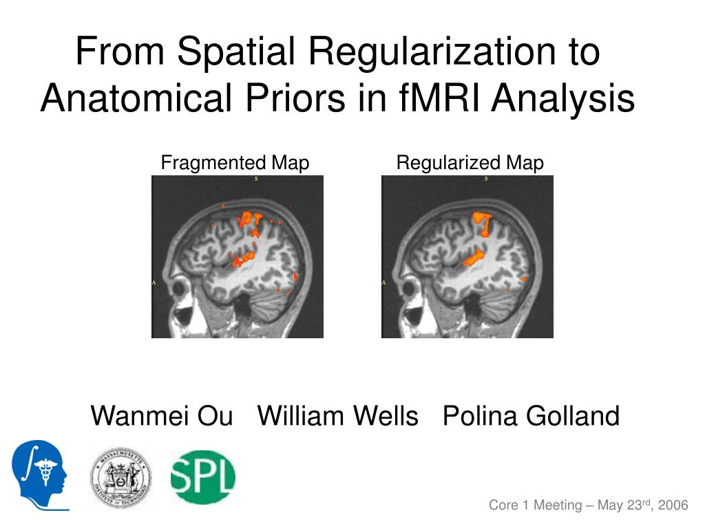 PPT - From Spatial Regularization to Anatomical Priors in fMRI Analysis ...