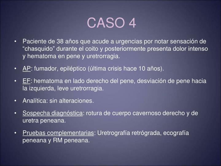 caso 4