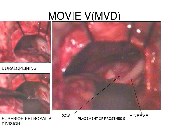 movie v mvd