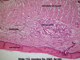 Slide 114, monkey lip, H&amp;E, 4x obj.