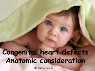 Congenital heart defects Anatomic consideration