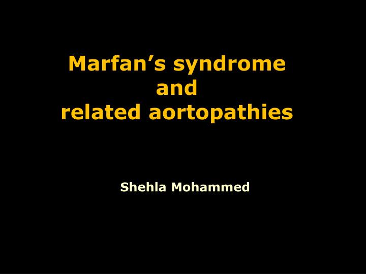 marfan s syndrome and related aortopathies