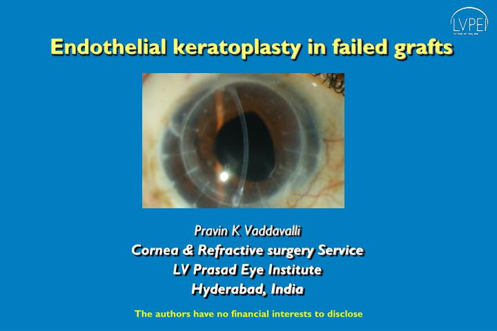 endothelial keratoplasty in failed grafts
