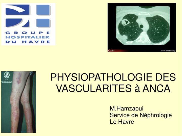 m hamzaoui service de n phrologie le havre