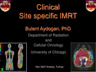 Clinical Site specific IMRT Bulent Aydogan, PhD
