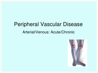 Peripheral Vascular Disease