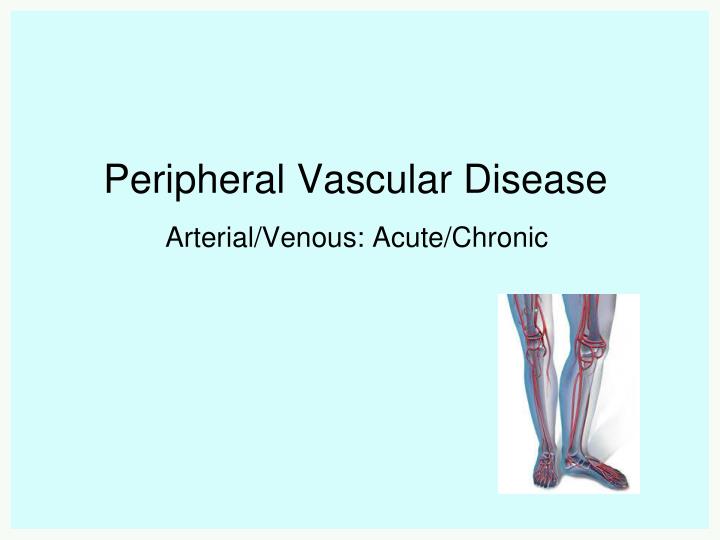 peripheral vascular disease