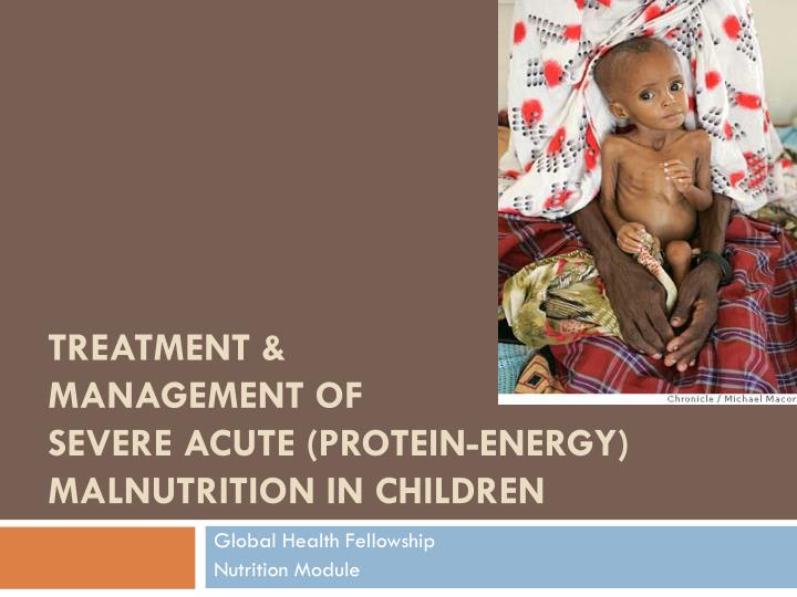treatment management of severe acute protein energy malnutrition in children