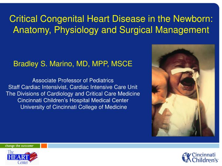 critical congenital heart disease in the newborn anatomy physiology and surgical management