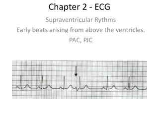 Chapter 2 - ECG