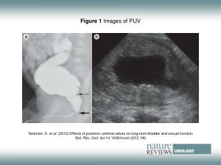 Figure 1 Images of PUV