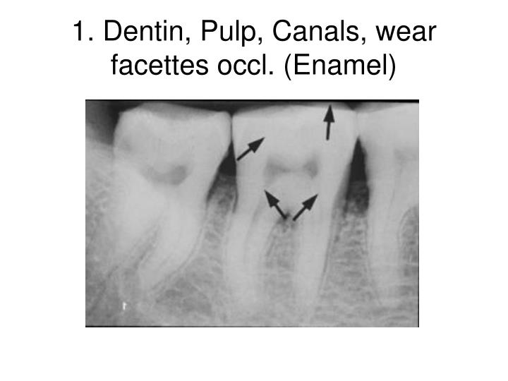 1 dentin pulp canals wear facettes occl enamel
