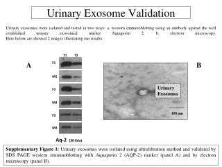 Urinary Exosome Validation