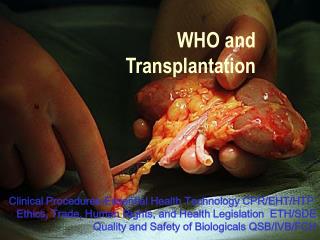 WHO and Transplantation