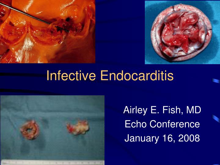 infective endocarditis