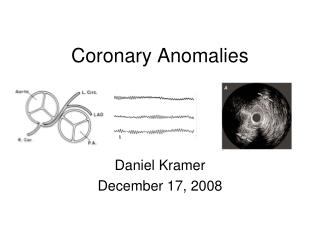 Coronary Anomalies