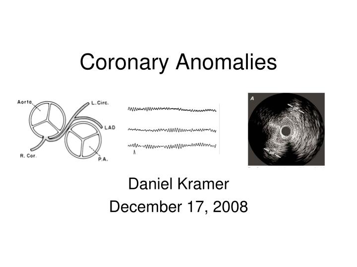coronary anomalies