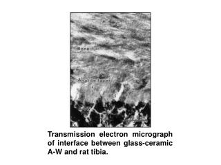 Transmission electron micrograph of interface between glass-ceramic A-W and rat tibia.
