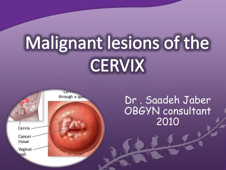 malignant lesions of the cervix